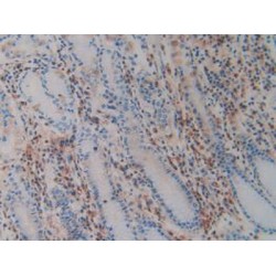 A Disintegrin And Metalloprotease 10 (ADAM10) Antibody