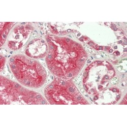 A Disintegrin And Metalloprotease 10 (ADAM10) Antibody
