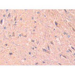 A Disintegrin And Metalloprotease 10 (ADAM10) Antibody