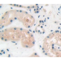 A Disintegrin And Metalloprotease 15 (ADAM15) Antibody