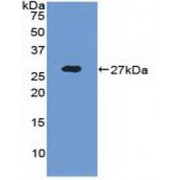 Western blot analysis of recombinant Human ADAM17.
