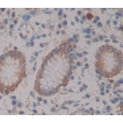 A Disintegrin And Metalloprotease 28 (ADAM28) Antibody