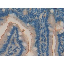 Tartrate-Resistant Acid Phosphatase 5 / TRACP5 (ACP5) Antibody