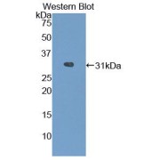 Western blot analysis of the recombinant protein.
