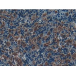 Tartrate-Resistant Acid Phosphatase 5 / TRACP5 (ACP5) Antibody