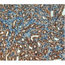 Tartrate-Resistant Acid Phosphatase 5 / TRACP5 (ACP5) Antibody