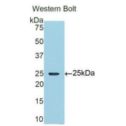 Western blot analysis of recombinant Human a1M.