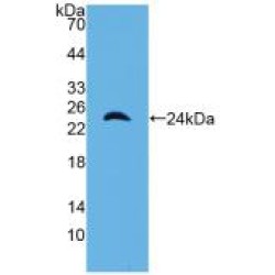 Protein AMBP (AMBP) Antibody