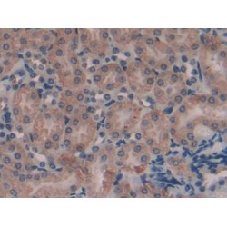 Protein AMBP (AMBP) Antibody