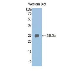 Protein AMBP (AMBP) Antibody