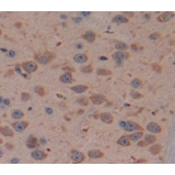 B-Cell CLL/Lymphoma 2 Like Protein 2 (Bcl2L2) Antibody