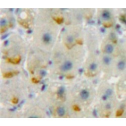 T-Lymphocyte Activation Antigen CD86 (CD86) Antibody