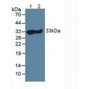 Western blot analysis of (1) Mouse Skeletal Muscle Tissue and (2) Rat Skeletal Muscle Tissue.