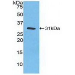 Carbonic Anhydrase III, Muscle Specific (CA3) Antibody