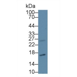 Cyclin-Dependent Kinase Inhibitor 2A (CDKN2A) Antibody