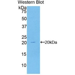 Cyclin-Dependent Kinase Inhibitor 2A (CDKN2A) Antibody