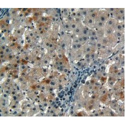 Cyclin-Dependent Kinase Inhibitor 2A (CDKN2A) Antibody