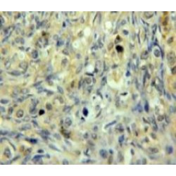 Glutathione S Transferase Mu 3, Brain (GSTm3) Antibody