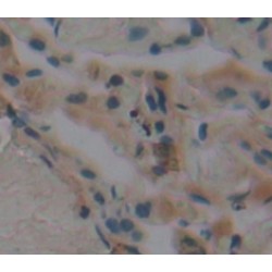 Growth Factor Receptor Bound Protein 7 (Grb7) Antibody