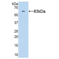 Heat Shock 60 kDa Protein 1, Chaperonin / HSP60 (HSPD1) Antibody