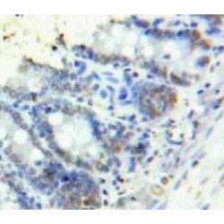 High Mobility Group Protein HMG-I / HMG-Y (HMGA1) Antibody