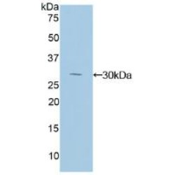 Inhibitory Subunit of NF Kappa B Delta (IkBd) Antibody