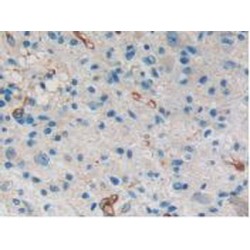 Inhibitory Subunit of NF Kappa B Delta (IkBd) Antibody