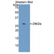 Western blot analysis of the recombinant Rat IGF2R protein.