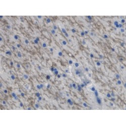 C-X-C Motif Chemokine 10 (CXCL10) Antibody