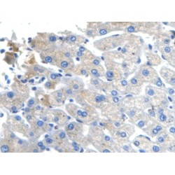 C-X-C Motif Chemokine 10 (CXCL10) Antibody