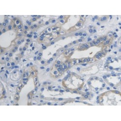 C-X-C Motif Chemokine 10 (CXCL10) Antibody
