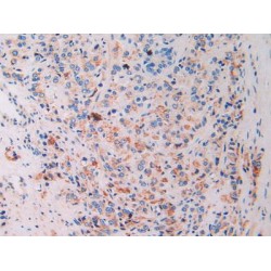 Interferon Gamma Inducible Protein 16 (IFI16) Antibody