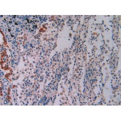 Interferon Gamma Inducible Protein 16 (IFI16) Antibody