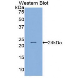 PC4 and SFRS1-Interacting Protein (PSIP1) Antibody