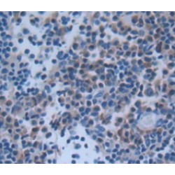 p53 Upregulated Modulator of Apoptosis (PUMA) Antibody
