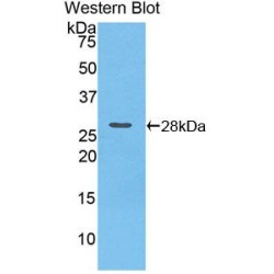 85 KDa Calcium-Independent Phospholipase A2 (PLA2G6) Antibody