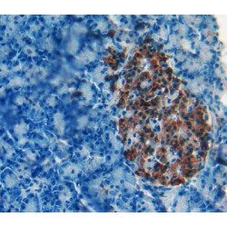 85 KDa Calcium-Independent Phospholipase A2 (PLA2G6) Antibody