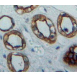Poliovirus Receptor Related Protein 2 (PVRL2) Antibody
