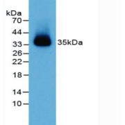 Western blot analysis of Mouse Heart Tissue.