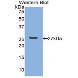 Poliovirus Receptor Related Protein 3 (NECTIN3) Antibody