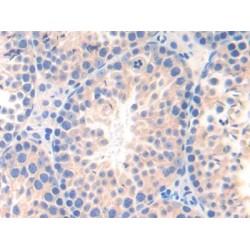 Poliovirus Receptor Related Protein 3 (NECTIN3) Antibody