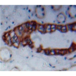 Poliovirus Receptor Related Protein 3 (NECTIN3) Antibody