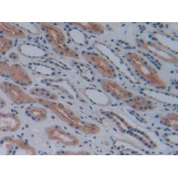Prostaglandin G/H Synthase 1 (PTGS1) Antibody