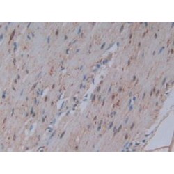 Prostaglandin G/H Synthase 1 (PTGS1) Antibody