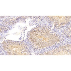 Prostaglandin G/H Synthase 2 / COX-2 (PTGS2) Antibody