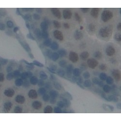 Protein Inhibitor of Activated STAT 1 (PIAS1) Antibody