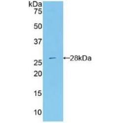 Antiviral Innate Immune Response Receptor RIG-I (RIGI) Antibody