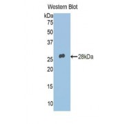 Western blot analysis of recombinant Human ADRP.