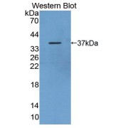 Western blot analysis of the recombinant protein.