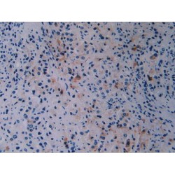 Breast Cancer Susceptibility Protein 1 (BRCA1) Antibody